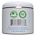 DermaSafe Stretch Mark Removal Cream - Scar Remover Creme - Advanced Moisturizer To Prevent and Diminish Marks and Scars - Large 4 oz