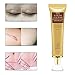 TCM Scar Cream, Acne Scar Removal Cream, Skin Repair Scars Burns Cuts Pregnancy Stretch Marks, Acne Spots Acne Treatment Blackhead Whitening Cream Stretch Marks for Face and Body (30ml)