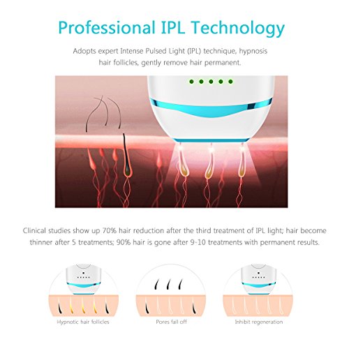 Xpreen IPL Hair Removal Device for Face and Body, Hair Removal System with Instense Pulsed Light