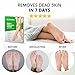 2 Pairs Foot Peel Mask