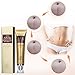 Acne Scar Removal Cream, Skin Repair Cream Scar Cream Gel Scar Treatment for Face and Body Scar Acne Spots Stretch Marks 30ml