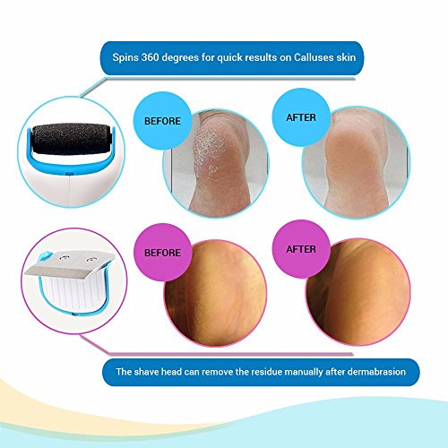 Pedicure Foot File Callus Remover, Includes 3 Extra Mineral Pumice