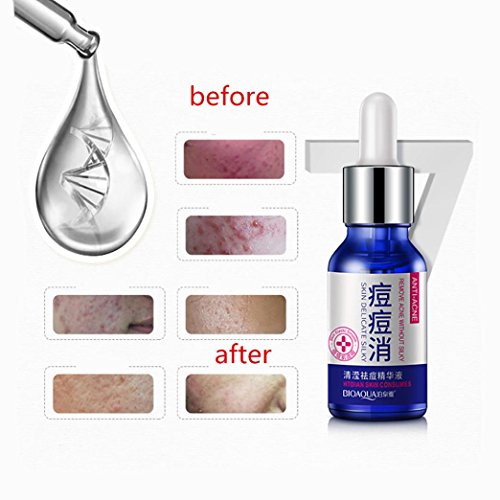 image for BananA_Light The new LED mosquito killer lamp 15W 1000LM 6500K electro