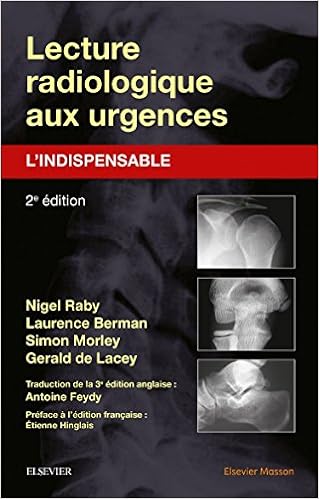 Lecture radiologique aux urgences : l'indispensable, by Nigel Raby Laurence Berman