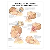 Wall Chart Whiplash Injuries of the Head and Neck Anatomical Chart Book
