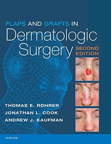 Amazon.com: Local Flaps in Facial Reconstruction E-Book eBook