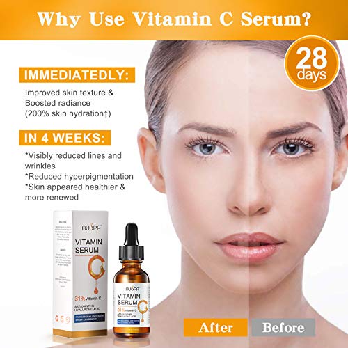 Organic Vitamin C Serum for Face/Neck/Eyes, Nuspa Facial Serum with 31