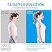 TURATA Posture Corrector for Men and Women Adjustable Upper Back Brace for Pain Relief, Clavicle Support, Thoracic Kyphosis from Neck, Back and Shoulder - FDA Approved