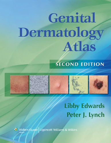 Download Genital Dermatology Atlas (English Edition) PDF