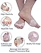 Gel Metatarsal Cushion Toe Separators - Forefoot Pad for Mortons Neuroma- Rapid Foot Pain Relief