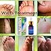 Wart Remover Foot Corn Removal Chicken Eye Liquid Wart Treatment Foot Corn Foot Callus Body Callus Calluses Foot Care Pads Wart Remover Corn Treatment Remover Plantar Wart Plantar for Women Manthumb 2
