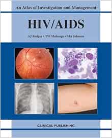 Hiv/ Aids: Atlas of Investigation and Management: Rodger, Alison J ...