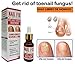 Antifungal FEM Get rid of toenail Fungus Uñas libres de Hongos 15 mlthumb 4