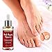 Nail Fungus Repair, Maximum Strength Fungal Toenail Solution, Nail Repair, Restores Healthy Appearance of Discolored & Damaged Nail