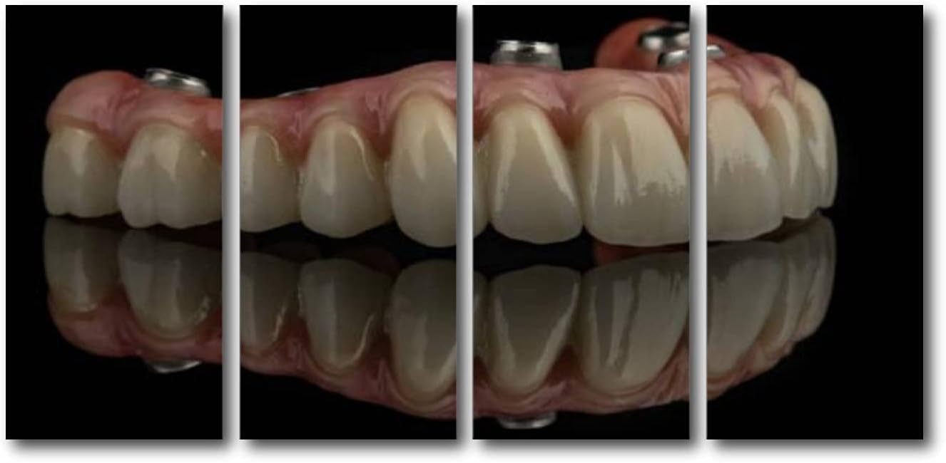 Paintings - LGCZNWDFHTZ Wall Art Prints Paintings Stretched & Framed Dental implants on a black background Poster Home Living Room Decoration Ready to Hang 4 Panel Canvas Pictures