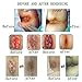 Chinese Herbal Hemorrhoids Cream, Natural Plant Hemorrhoids Treatment Cream Anal Cream for Internal Hemorrhoids Piles External Anal Fissure