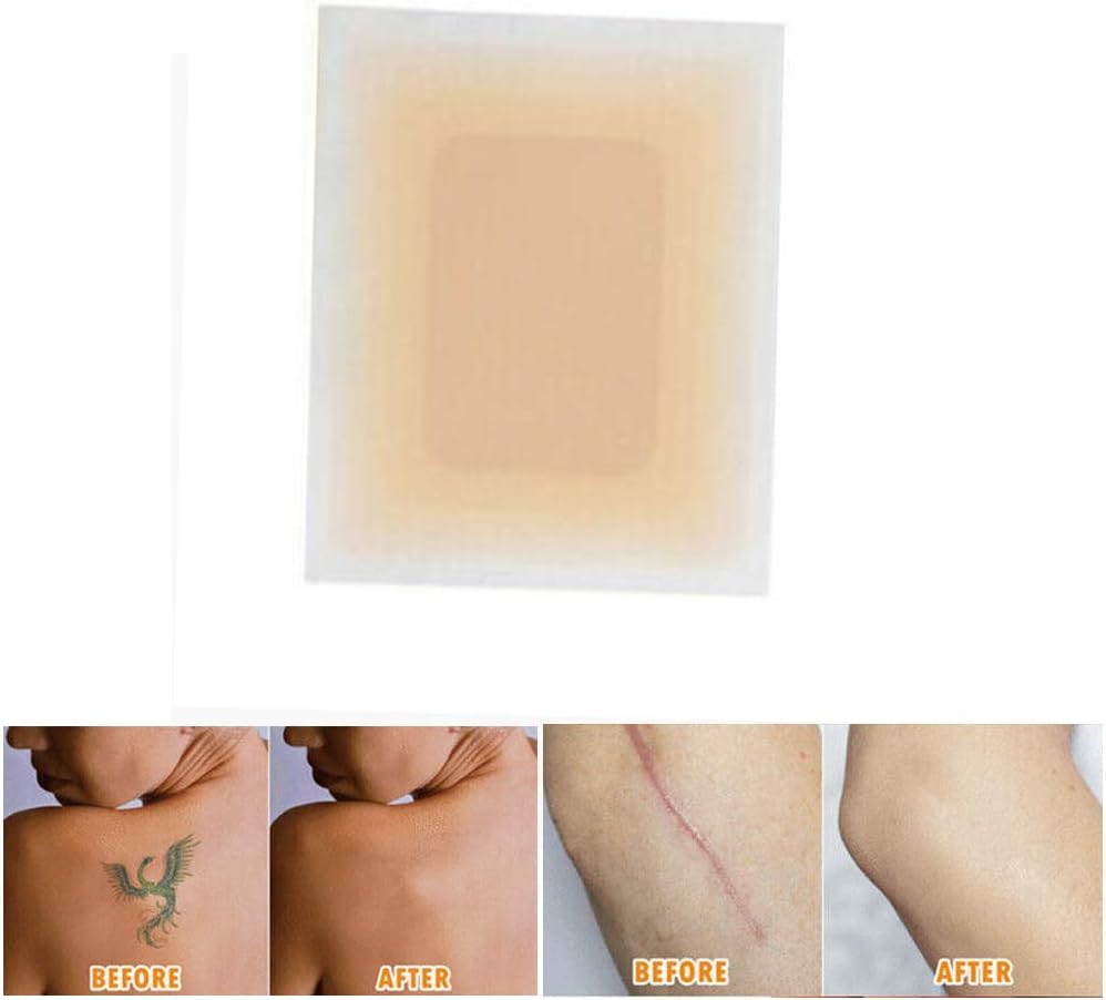 CHUANGE Tattoo & Flaw Covers Skin Shields Concealing Tapes Hiding Tattoo Flaw