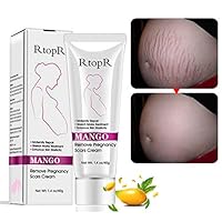 Zhengpin Mango Pregnancy Remove Scars Cream Maternity Repair Stretch Marks Skin Repair Moisturizer for Acne Scars, Stretch Marks（40g) (A)