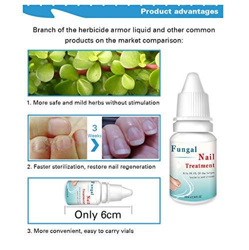 COM1950s Nail Care Anti Fungal Treatment Cream Strength Toenail Fungus Foot Fungi Nail Cream Safe and Less Painful Easy to Carry 2pcs (Blue, 2PC)