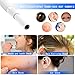 Cakler Ear Otoscope, Wireless Ear Endoscope, 1.3 Megapixels Wifi Ear Scope Camera USB Ear Cleaning Tool, Digital Inspection Camera with 6 Adjustable LEDs for iPhone and Android Smartphone, Windows