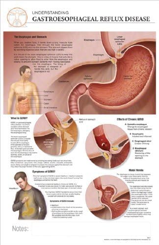 11 x 17 Post-It Disease Chart: Gastroesophageal Reflux GERD