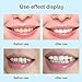 Teeth Whitening Pen, Safe 35% Carbamide Peroxide Gel, 20+ Uses, Painless, No Sensitivity, Easy to Use, Natural Mint Flavor