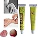 5Pcs Herbal Antibacterial Anti-Itching Cream Perfect for Dermatitis and Eczema Pruritus Body Psoriasis Treatment Materia Medica Ointment