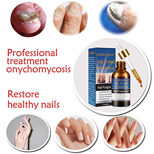Nail Treatment,Repair Toenails,Nail Repair Solution, Nail Treatment Care for Nails and Cuticles - Thumbnail 4
