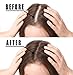 Hair Growth Serum, Votala Hair Growth Treatment, Hair Serum, Anti Hair Loss, Thinning, Balding, Repairs Hair Follicles, Promotes Thicker, Stronger Hair, And Promotes Hair Regrowththumb 4