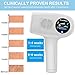 PretiHom Facial & Body Permanent Laser Hair Removal for Women and Men - IPL Hair Remover Cold Compress 400,000 Flashes Home Use Hair Removal System
