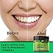 Natural Charcoal Teeth Whitening Powder - Coconut Activated Charcoal - Best Tooth Whitener For Sensitive Teeth - Naturally Whitens Teeth - Mint Flavor For Fresh Breath