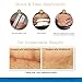 Embrace Active Scar Defense for New Scars, FDA-Cleared Medical-Grade Silicone Scar Sheets for Hypertrophic & Keloid Scar Treatment, 4.7 Inch, Large, 60-Day Supply