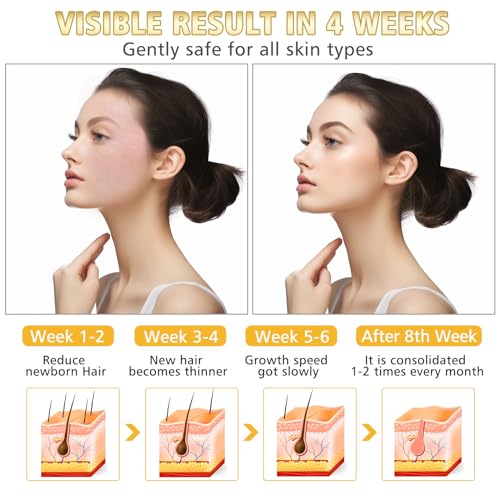 WAYCOM Facial Hair Remover Threading Hair Removal for Women Automatic Threader Machine Epilator for Fine Hairs on Face, Chin, Upper Lip, Arms Birthday Mother's Day Present