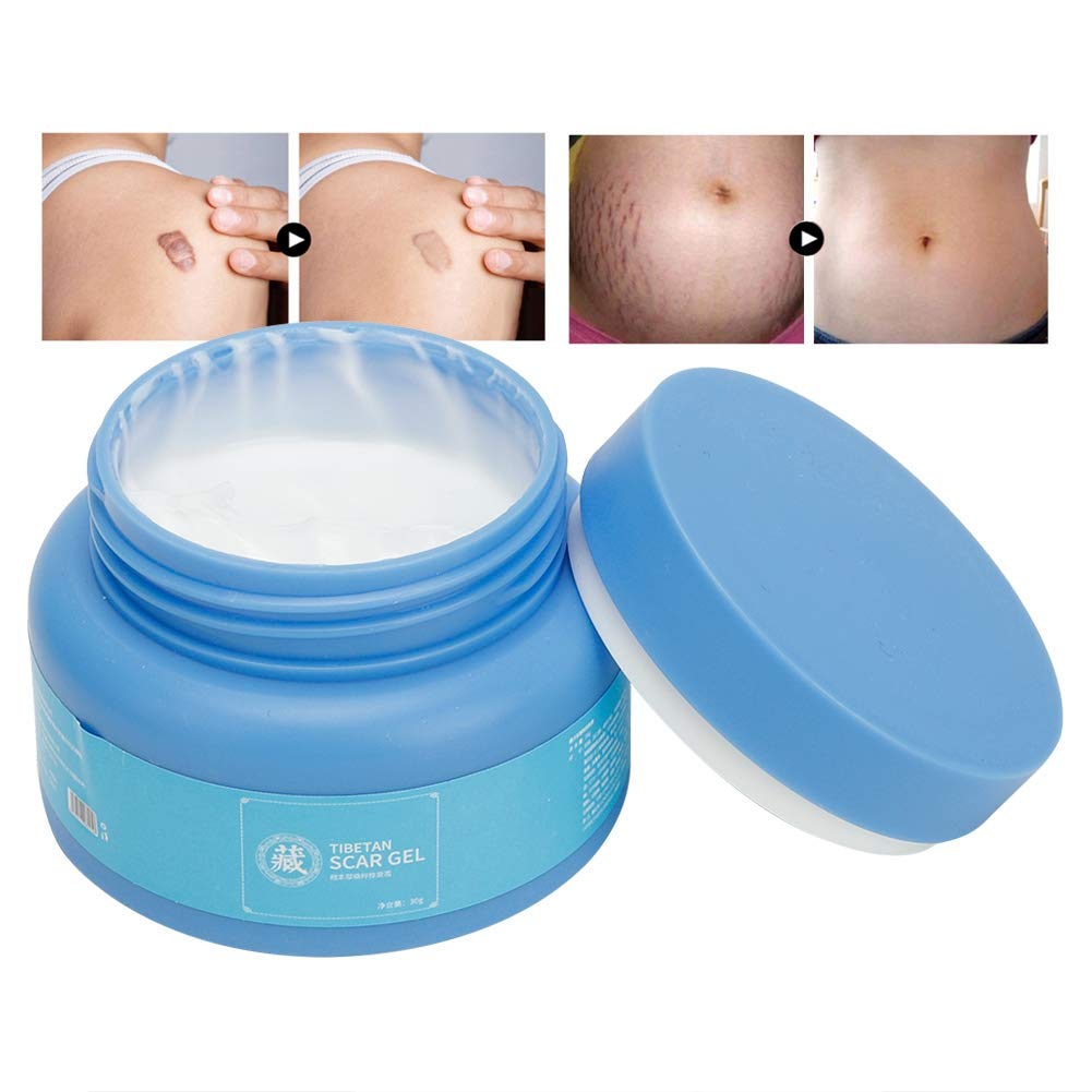 acne scar removal cream amazon