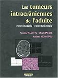 Les tumeurs intracrâniennes de l'adulte à l'exclusion de la base du crâne et de la région hypoph by 