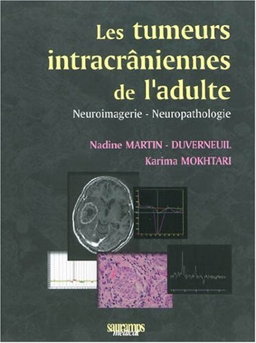 Les tumeurs intracrâniennes de l'adulte à l'exclusion de la base du crâne et de la région hypoph by Nadine Martin-Duverneuil, Karima Mokhtari