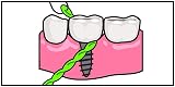 iDontix IDontix Brace X-Floss Green Dental Floss Tool view 5