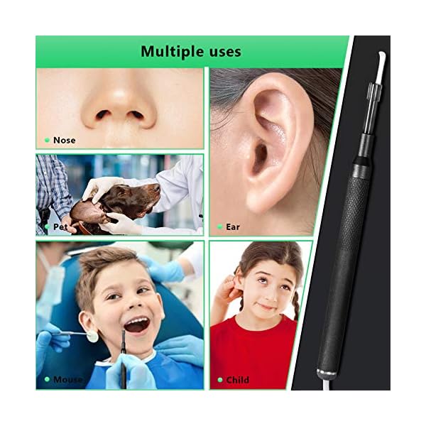 gracosy Visueller Ohrstöpsel Ohrreiniger Mikroskop Inspektionskamera Smart Endoscope Ohrenschmalzentfernungsotoskop 3,9… – Bild 3