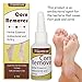 Corn Remover, Callus Remover, Callus Eliminator, Callus And Corn Remover Liquid, Professional Grade