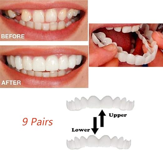 Amazon Co Jp 9ペアインスタントスマイル歯ホワイトニング歯スナップ化粧品義歯底とトップ化粧品突き板快適な歯科ケアツール ホーム キッチン