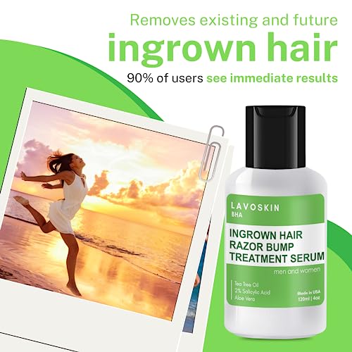 LAVO Tea Tree Gel w/Salicylic Acid BEST Ingrown Hair Treatment