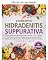 Livro Vivendo com HS: o protocolo dietético para hidradenite supurativa — terapia com zinco, reset do microbioma intestinal, eliminação de alimentos gatilho e plano anti-inflamatório de 28 dias com 75...