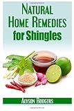 Natural Home Remedies for Shingles