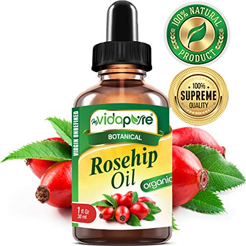ORGANIC ROSEHIP OIL with high contents of Vitamins A, C, E. For WRINKLES, SCARS, STRETCH MARKS, Face, Body, Hair, Lip Care, 1 Fl.oz.- 30 ml. by myVidaPure