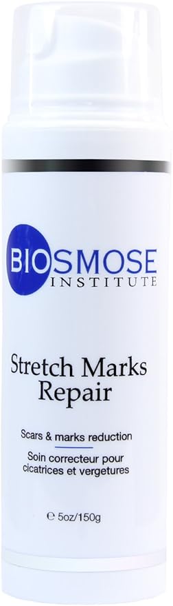 biosmose stretch marks repair