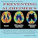 Preventing Alzheimer's: Alzheimer's Factors, Prevention Steps and Foods that Prevent or Slow Alzheim by