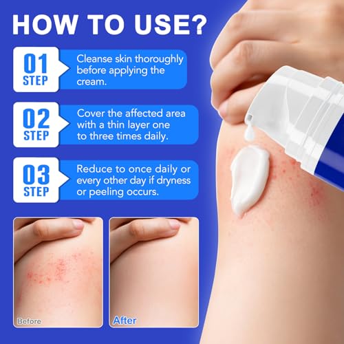 Folliculitis Cream 100g, Multi-Purpose Cream for Oily & Blemish-Prone Skin, Gentle Herbal Care for Smooth, Calm the Look of Redness, help reduce excess oil appearance, Suitable for Scalp, Face & Body