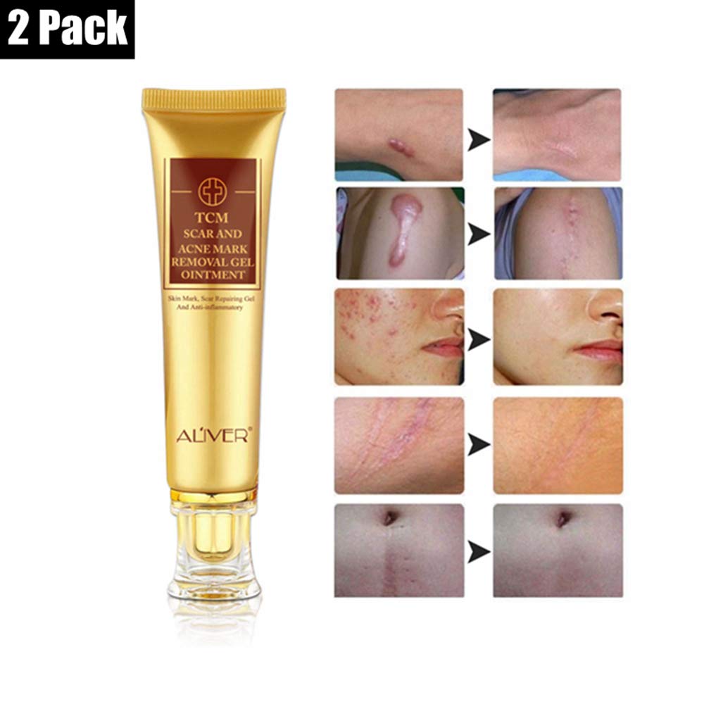 2 pack Scar and Acne Marks Removal Ointment Gel, Scar Removal Cream, Skin Repair - Scars Burns Cuts, Stretch Marks, Acne Spots, Naturals Scar Cream for Face and Body : Beauty