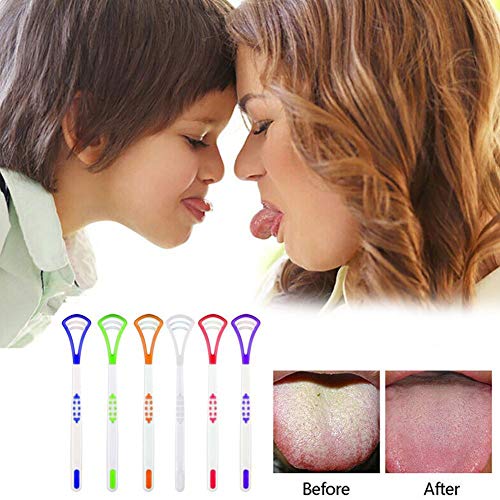 Come Pulire Correttamente La Lingua Per Evitare Alito Cattivo - Foto 3