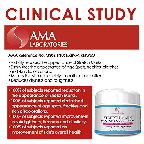 Stretch Mark Cream for Pregnancy & Scar Removal 100 RETINOL FREE